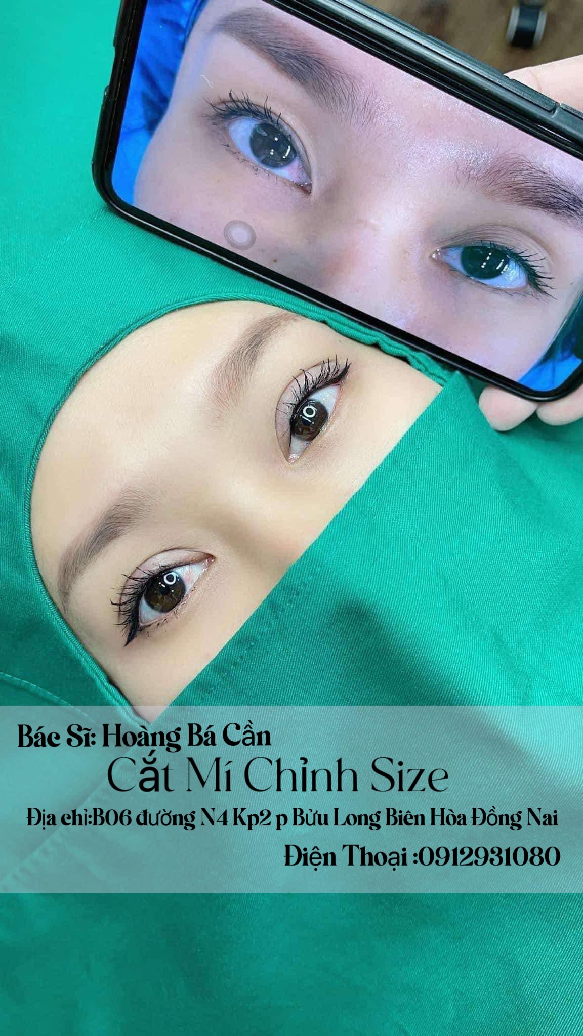 CẮT MÍ - CHỈNH SIZE